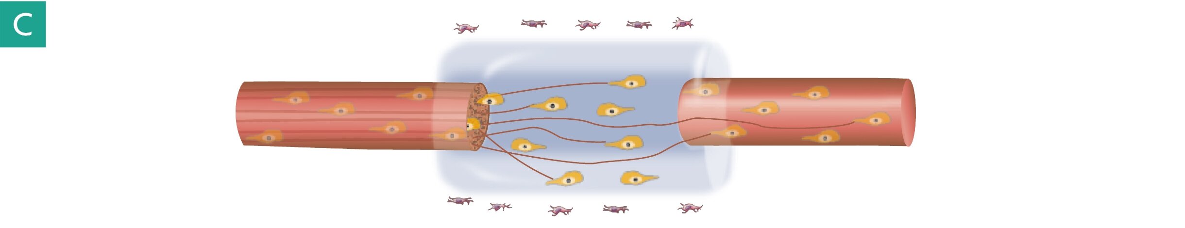 Step C: Axon growth