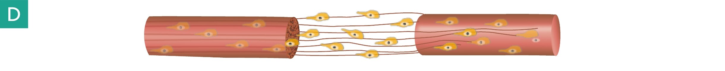 Step D: Full nerve reconnection