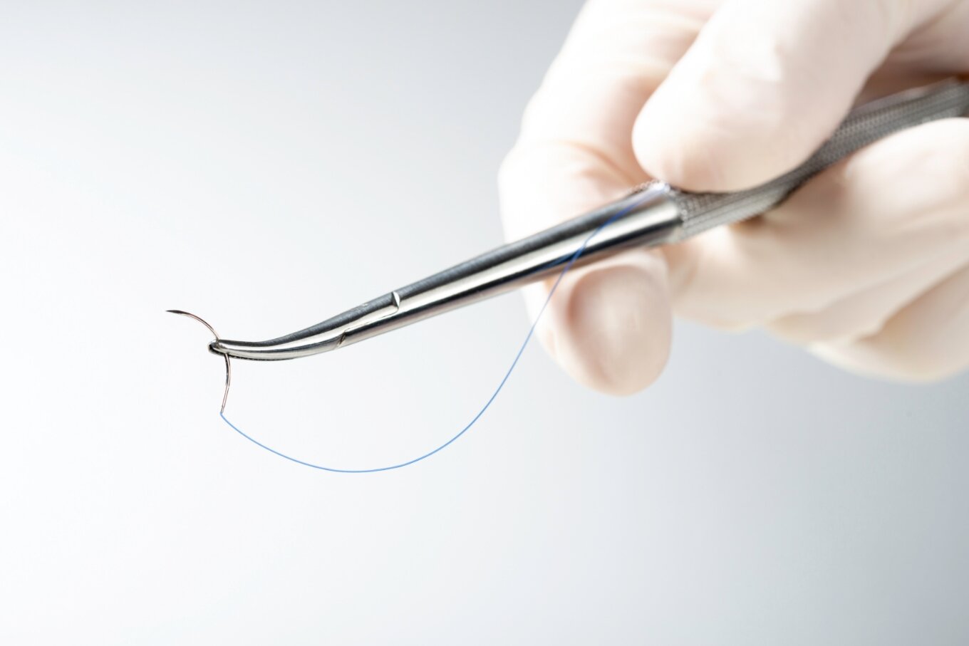 Minimal suturing required